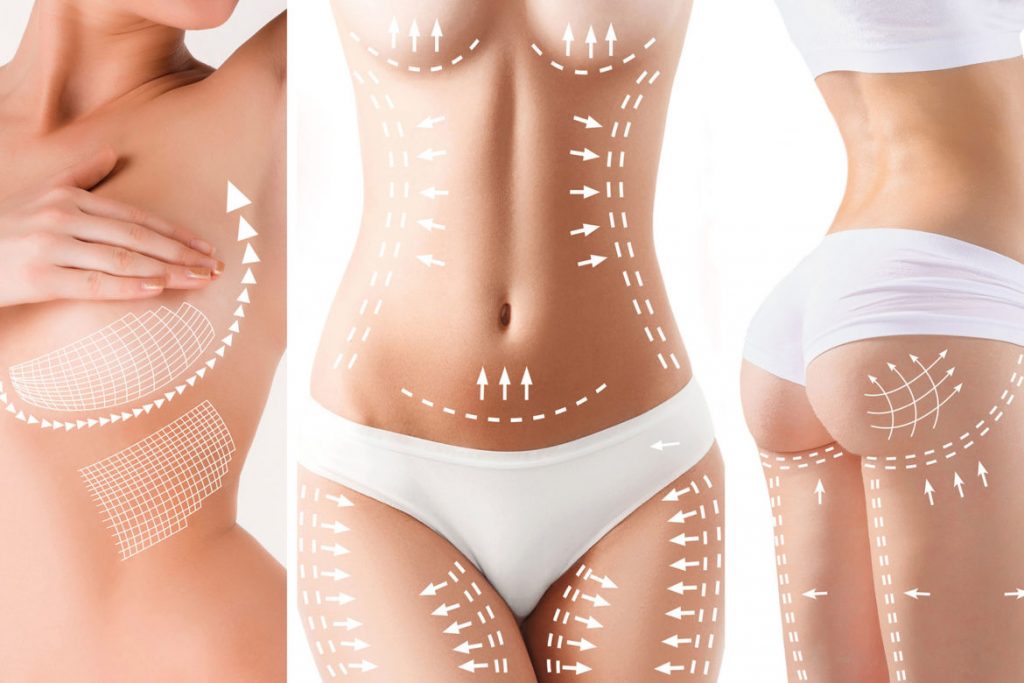 Body Contouring Vancouver